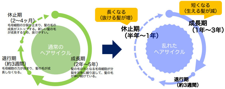 ヘアサイクルの乱れ