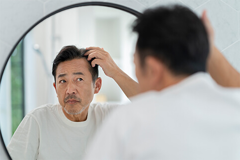 AGA治療